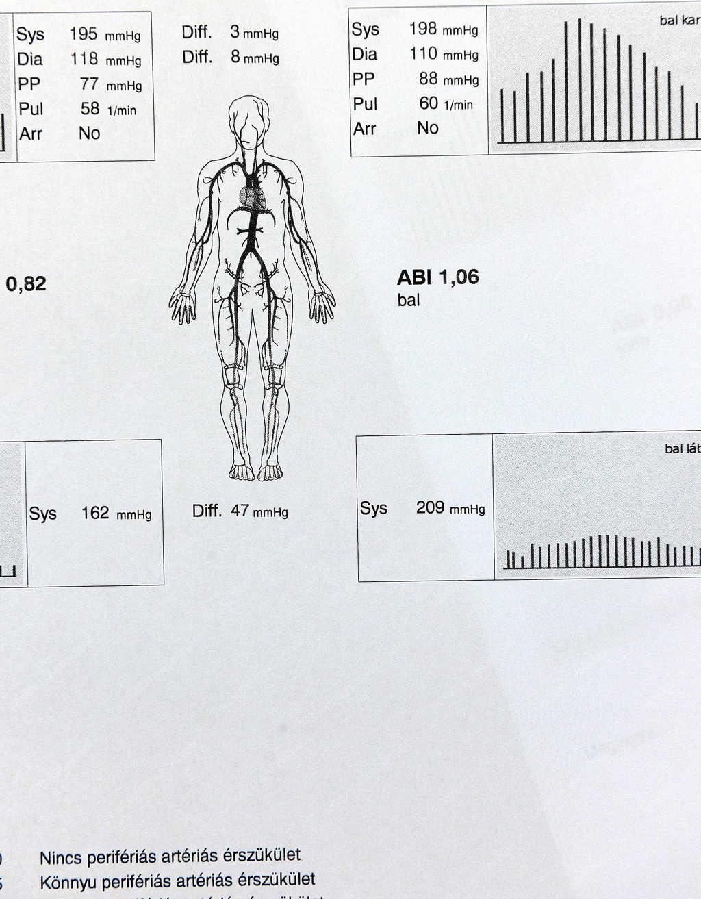 Egészségügy - Debrecen - Érszűkület diagnosztika