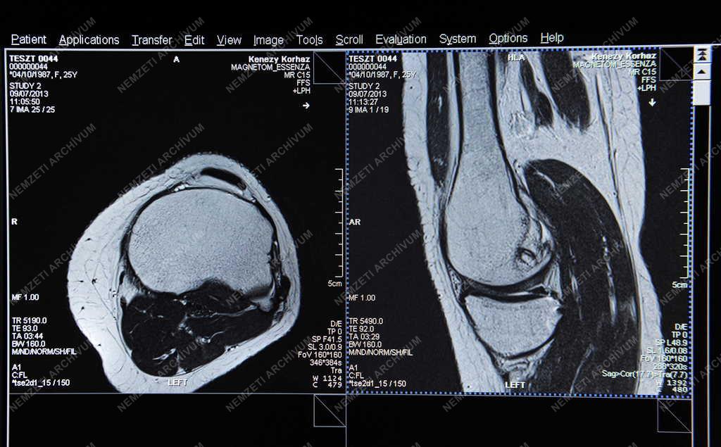 Egészségügy - Debrecen - MRI készülék a Kenézy Kórházban