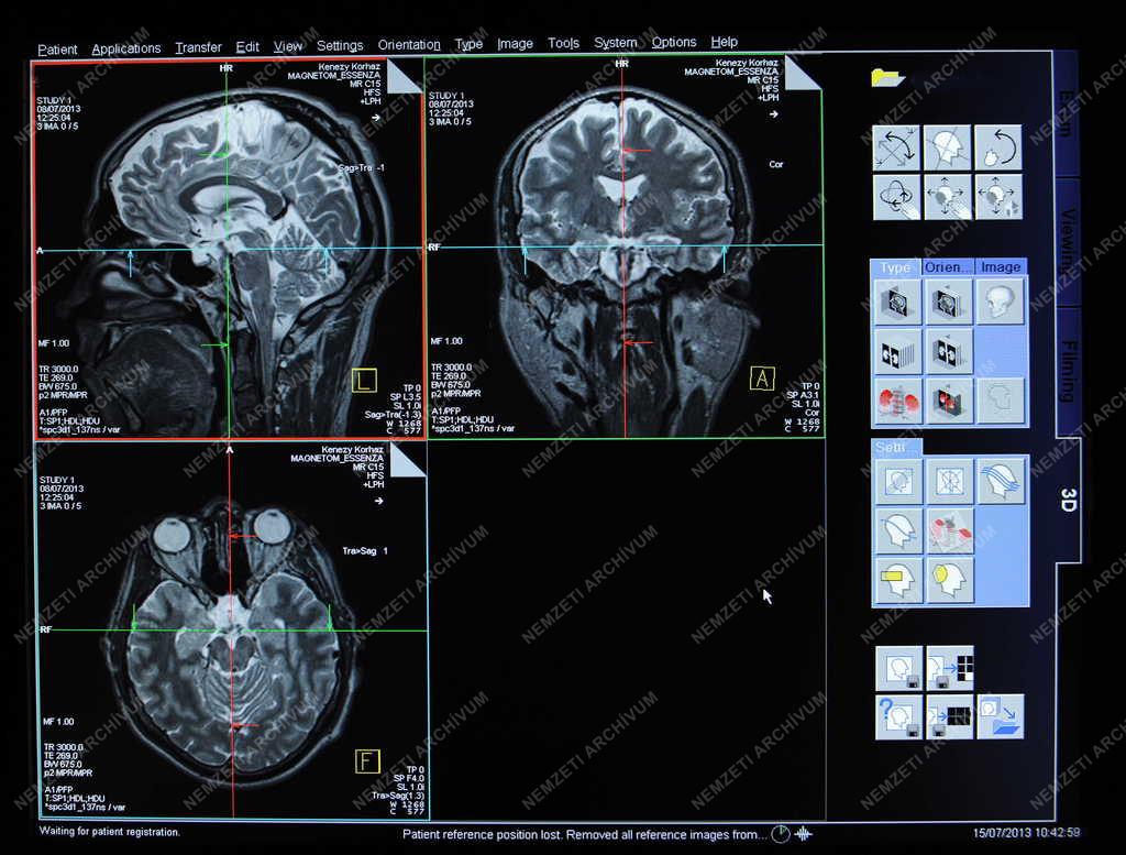 Egészségügy - Debrecen - MRI készülék a Kenézy Kórházban
