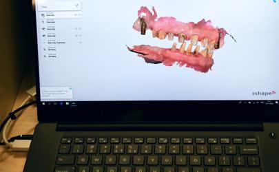 Oktatás - Debrecen - Digitális fogászati képzés az egyetemen